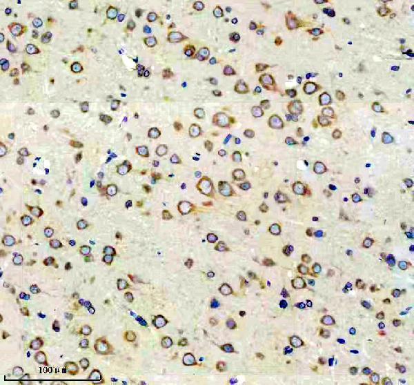 m00192 fmr1 primary antibodies ihc testing 3