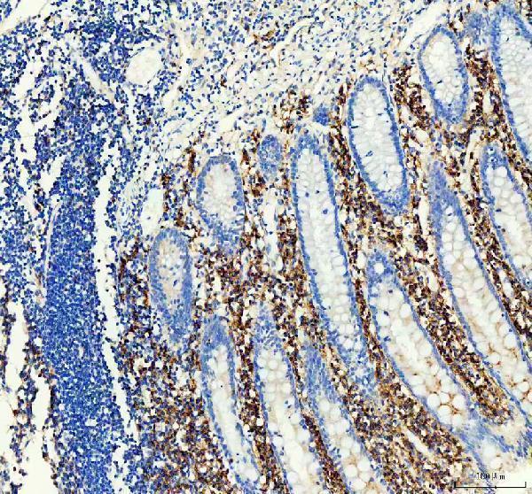IHC analysis of CD38 using anti-CD38 antibody (M00193)