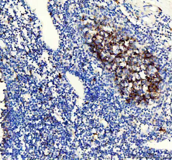 IHC analysis of CD38 using anti-CD38 antibody (M00193)