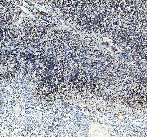 m00193 cd38 primary antibodies ihc testing 3