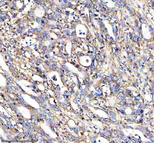  IHC analysis of HLA-A using anti-HLA-A antibody (M00194-1)