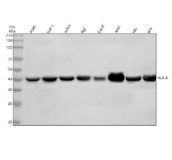  Western blot analysis of HLA-A using anti-HLA-A antibody (M00194-1)
