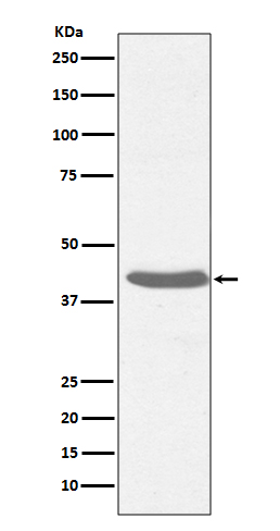 Western blot analysis of MHC class I expression in Raji cell lysate