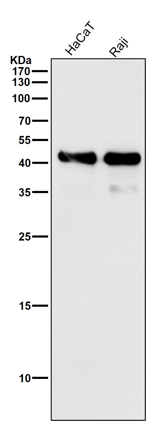 All lanes use the Antibody at 1:1K dilution for 1 hour at room temperature