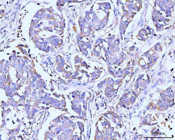  IHC analysis of ITCH/AIP4 using anti-ITCH/AIP4 antibody (M00195-1)