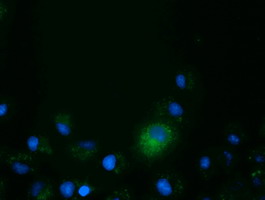 Anti-CD80 mouse monoclonal antibody (M00196-3) immunofluorescent staining of COS7 cells transiently transfected by pCMV6-ENTRY CD80