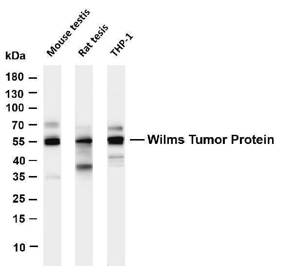 Various whole cell lysates were separated by 4-20% SDS-PAGE, and the membrane was blotted with anti-Wilms Tumor Protein antibody