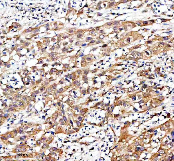 m00200 1 fgfr3 primary antibodies ihc testing 3