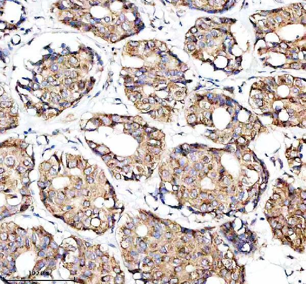 m00200 1 fgfr3 primary antibodies ihc testing 4