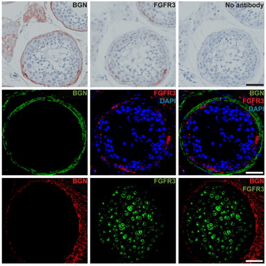 Figure from citation: Immunohistochemical and Immunofluorescense staining with anti-BGN and anti-FGFR3 of serial sections of adult human testis tissue with full spermatogenesis and fetal bone sample (gestational week 10)