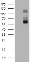 HEK293T cells were transfected with the pCMV6-ENTRY control (Left lane) or pCMV6-ENTRY FGFR3 (Right lane) cDNA for 48 hrs and lysed