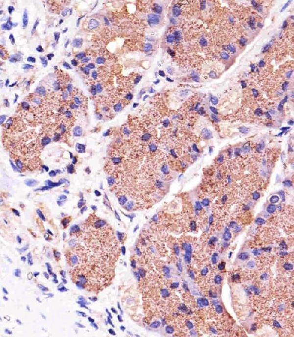 m00201 anti pink1 antibody ihc p testing 3