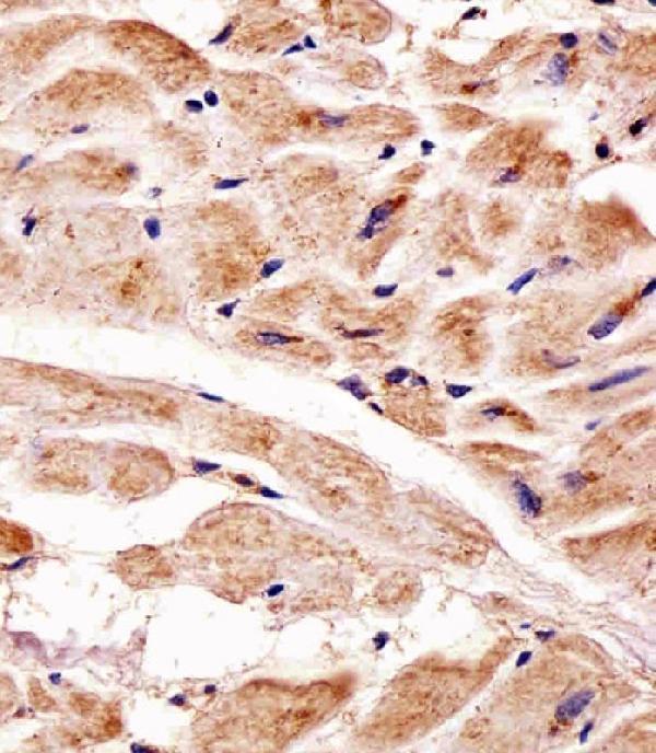 m00201 anti pink1 antibody ihc p testing 4