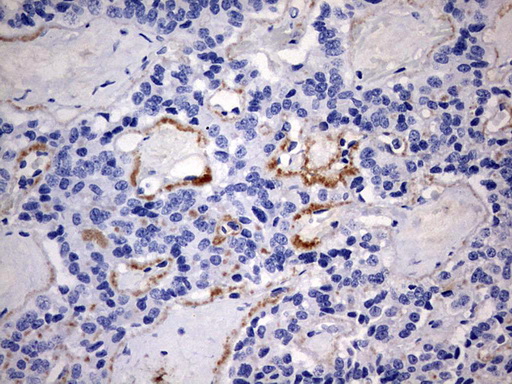 m00202 1 anti rip3 ripk3 mouse monoclonal antibody clone id oti1b3 ihc testing 3