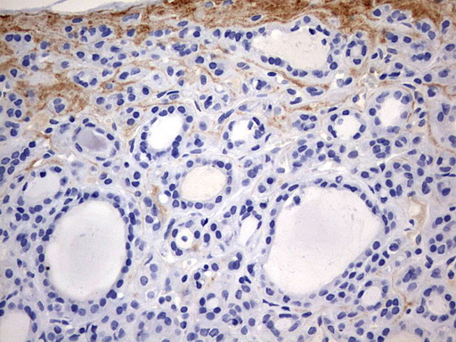 m00202 1 anti rip3 ripk3 mouse monoclonal antibody clone id oti1b3 ihc testing 4