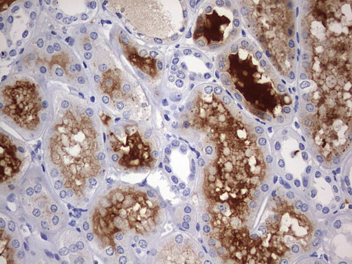 m00202 1 anti rip3 ripk3 mouse monoclonal antibody clone id oti1b3 ihc testing 5