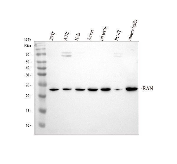 Western blot analysis of Ran using anti-Ran antibody (M00204-1)