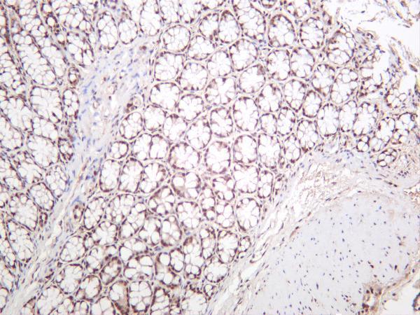 Mouse colon was stained with anti-CREBBP rabbit antibody