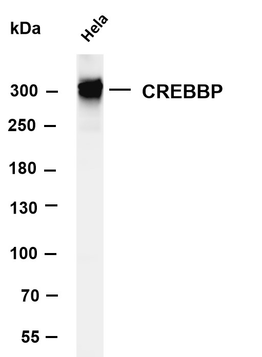 Various whole cell lysates were separated by 4-8% SDS-PAGE, and the membrane was blotted with anti-CREBBP antibody