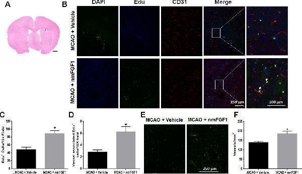 Non-mitogenic fibroblast growth factor 1 (nmFGF1) promoted angiogenesis in ischemic boundary following ischemia stroke