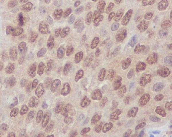 m00207 1 ihc_1