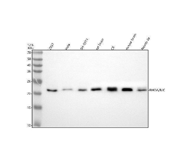  Western blot analysis of Rho A+B+C using anti-Rho A+B+C antibody (M00207-1)