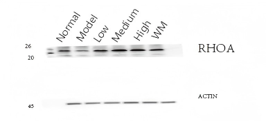 m00207 1 rho a_b_c primary antibodies wb testing 3_1