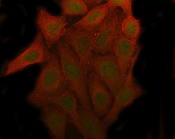 Figure 1: Monoclonal antibodies recognize a specific epitope, whereas polyclonal antibodies recognize multiple epitopes.