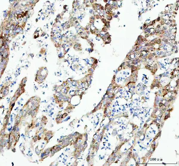  IHC analysis of CDK1 using anti-CDK1 antibody (M00209-2)