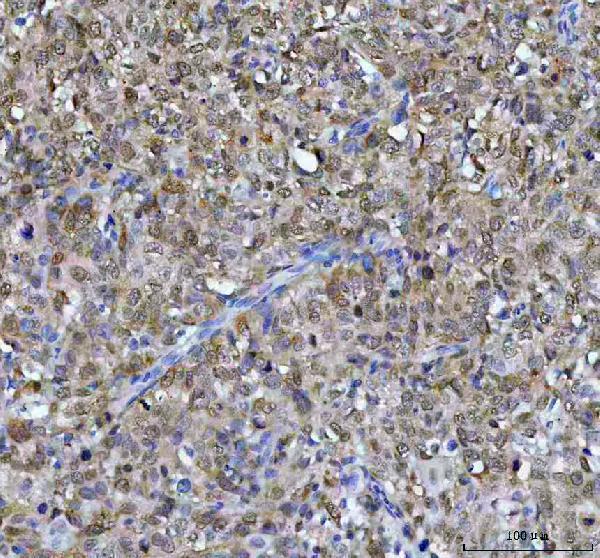  IHC analysis of CDK1 using anti-CDK1 antibody (M00209-2)