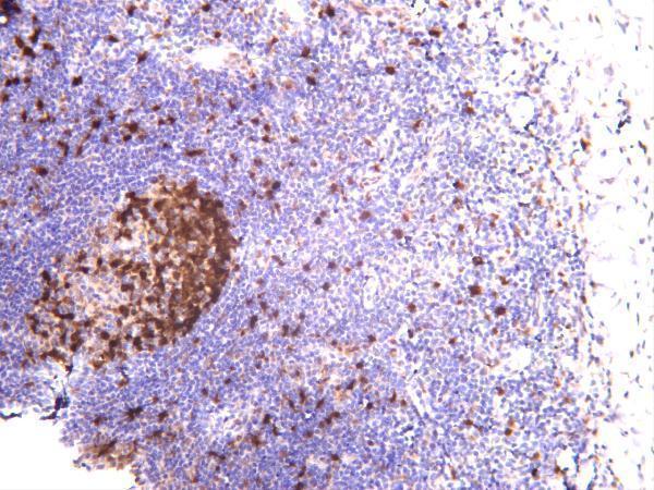 Human tonsil was stained with anti-Cdc2 rabbit antibody