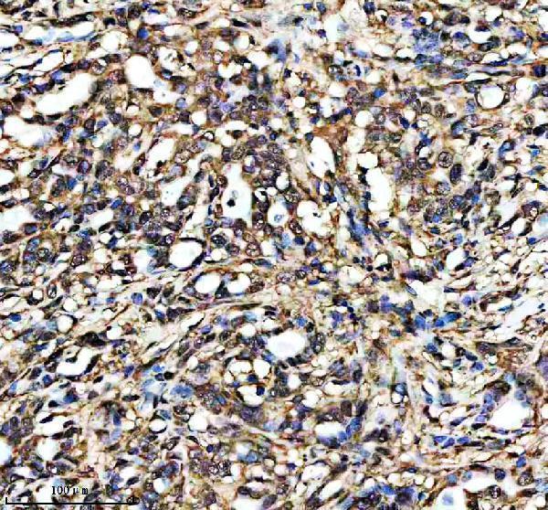 m00209t160t161 p cdk1 2 primary antibodies ihc testing 3