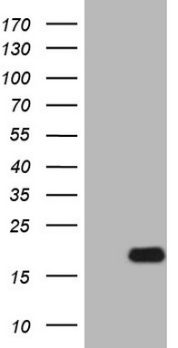 HEK293T cells were transfected with the pCMV6-ENTRY control (Left lane) or pCMV6-ENTRY IL15 (Right lane) cDNA for 48 hrs and lysed
