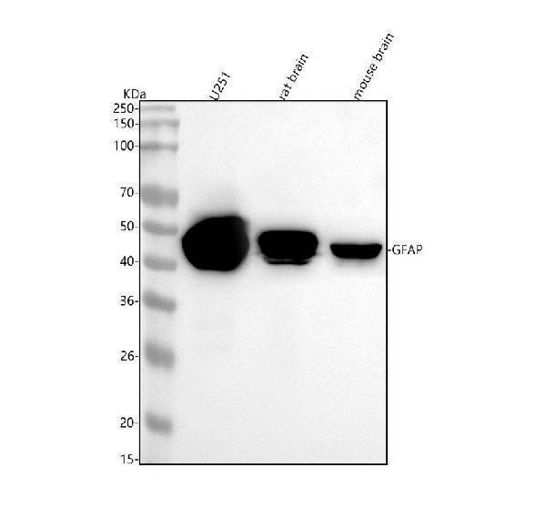  Western blot analysis of GFAP using anti-GFAP antibody (M00213-1)