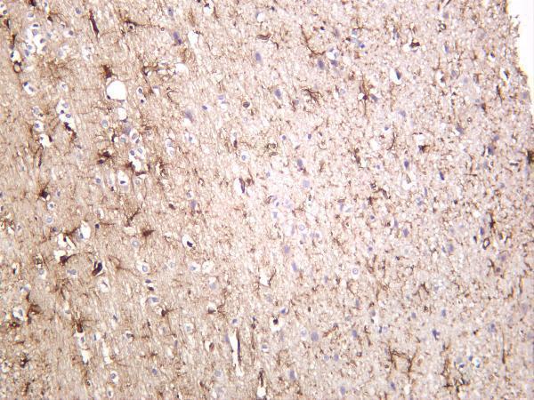 Rat brain was stained with anti-GFAP rabbit antibody