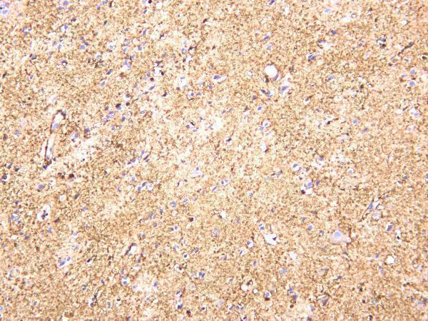Human brain was stained with anti-GFAP rabbit antibody