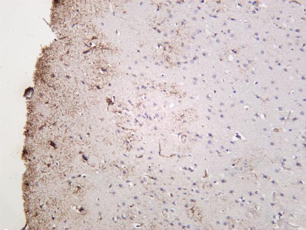 Mouse brain was stained with anti-GFAP rabbit antibody