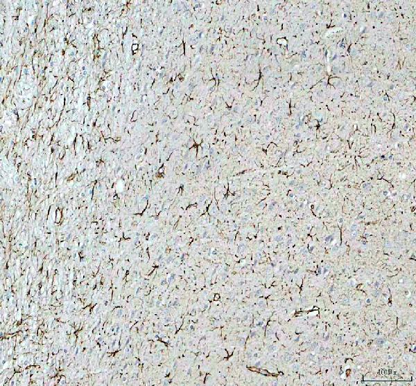 m00213 8 gfap primary antibodies ihc testing 4