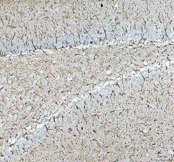 m00213 8 gfap primary antibodies ihc testing 5