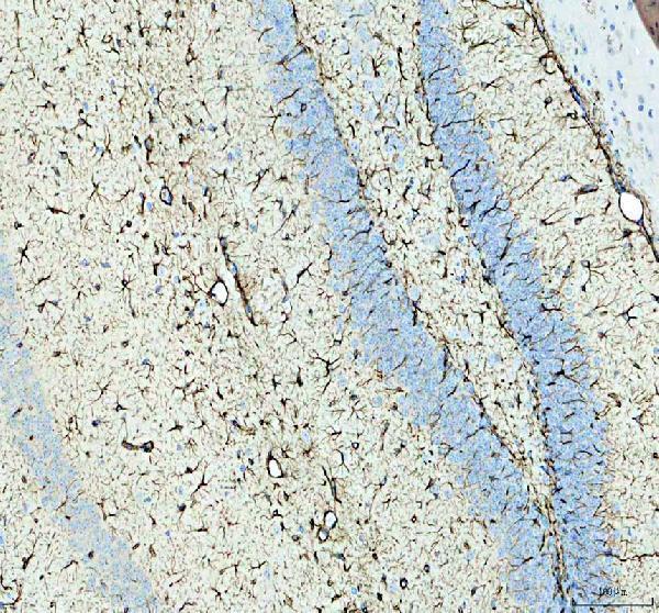 m00213 8 gfap primary antibodies ihc testing 6
