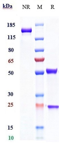 Anti-IL-2Ra/CD25 Reference Antibody (daclizumab) on SDS-PAGE under reducing (R) condition
