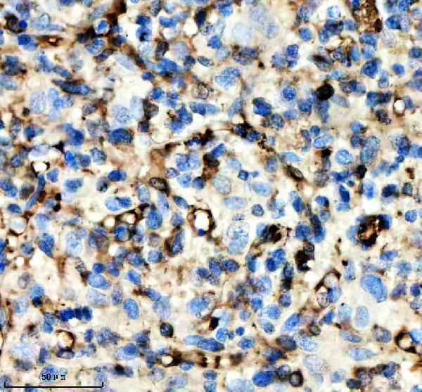 IHC analysis of SNCA using anti-SNCA antibody (M00215-1)