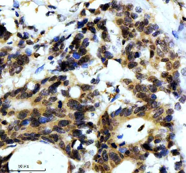 IHC analysis of SNCA using anti-SNCA antibody (M00215-1)