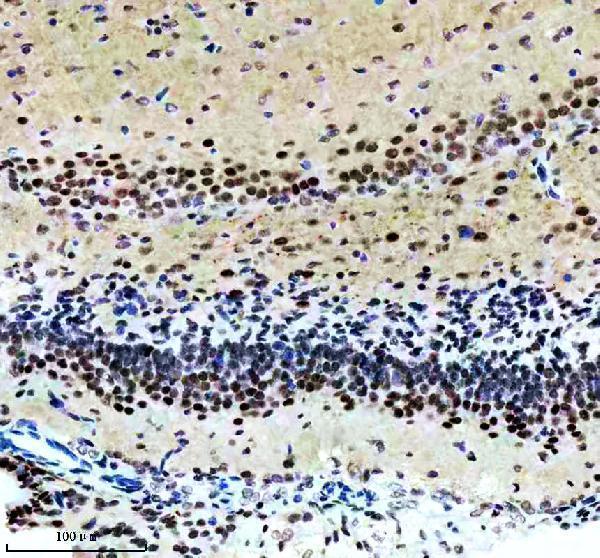 m00215 1 snca primary antibodies ihc testing 3