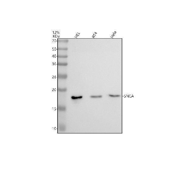Western blot analysis of SNCA using anti-SNCA antibody (M00215-1)