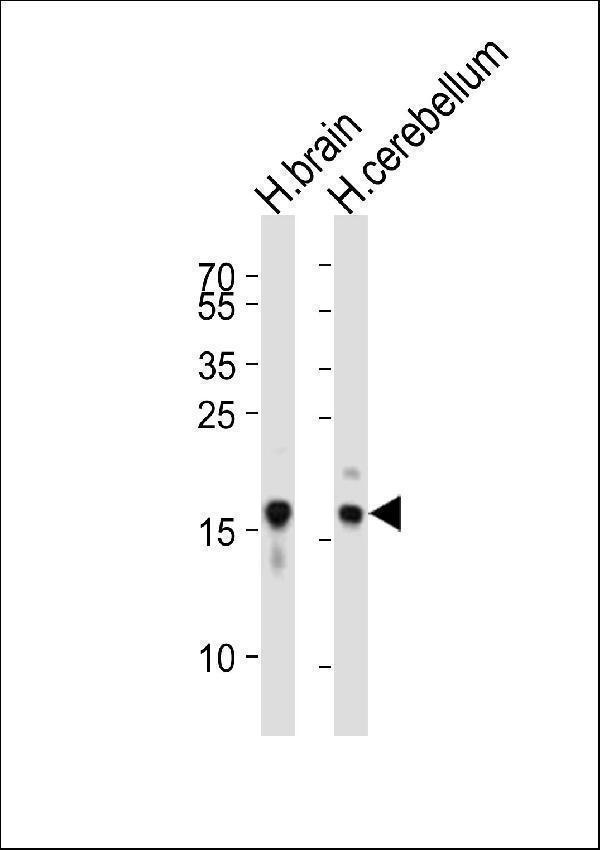 m00215 2 anti snca antibody c term wb testing 1