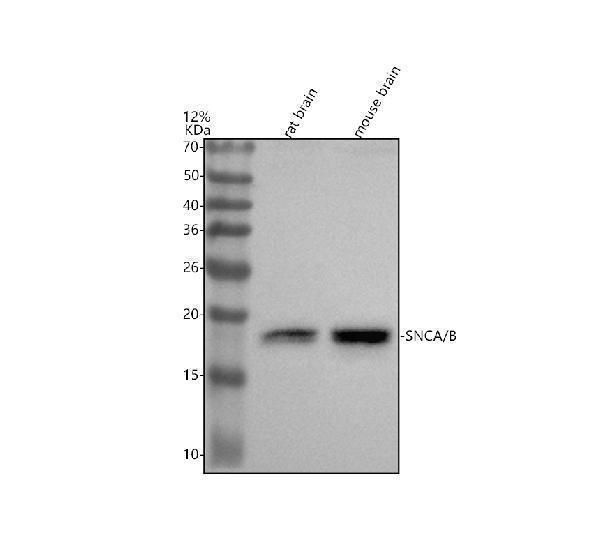 Western blot analysis of SNCA/B using anti-SNCA/B antibody (M00215)