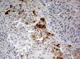 m00217 2 anti lkb1 stk11 mouse monoclonal antibody clone id oti0a3 ihc testing 2