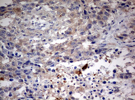 m00217 2 anti lkb1 stk11 mouse monoclonal antibody clone id oti0a3 ihc testing 3
