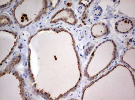 m00217 2 anti lkb1 stk11 mouse monoclonal antibody clone id oti0a3 ihc testing 5